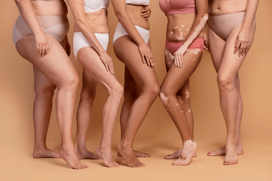 Nous voyons 5 femmes en mayo de bain avec des tâches pour certaines montrant l'acceptation de son corps mais aussi pour montrer des résultat dû aux massages.